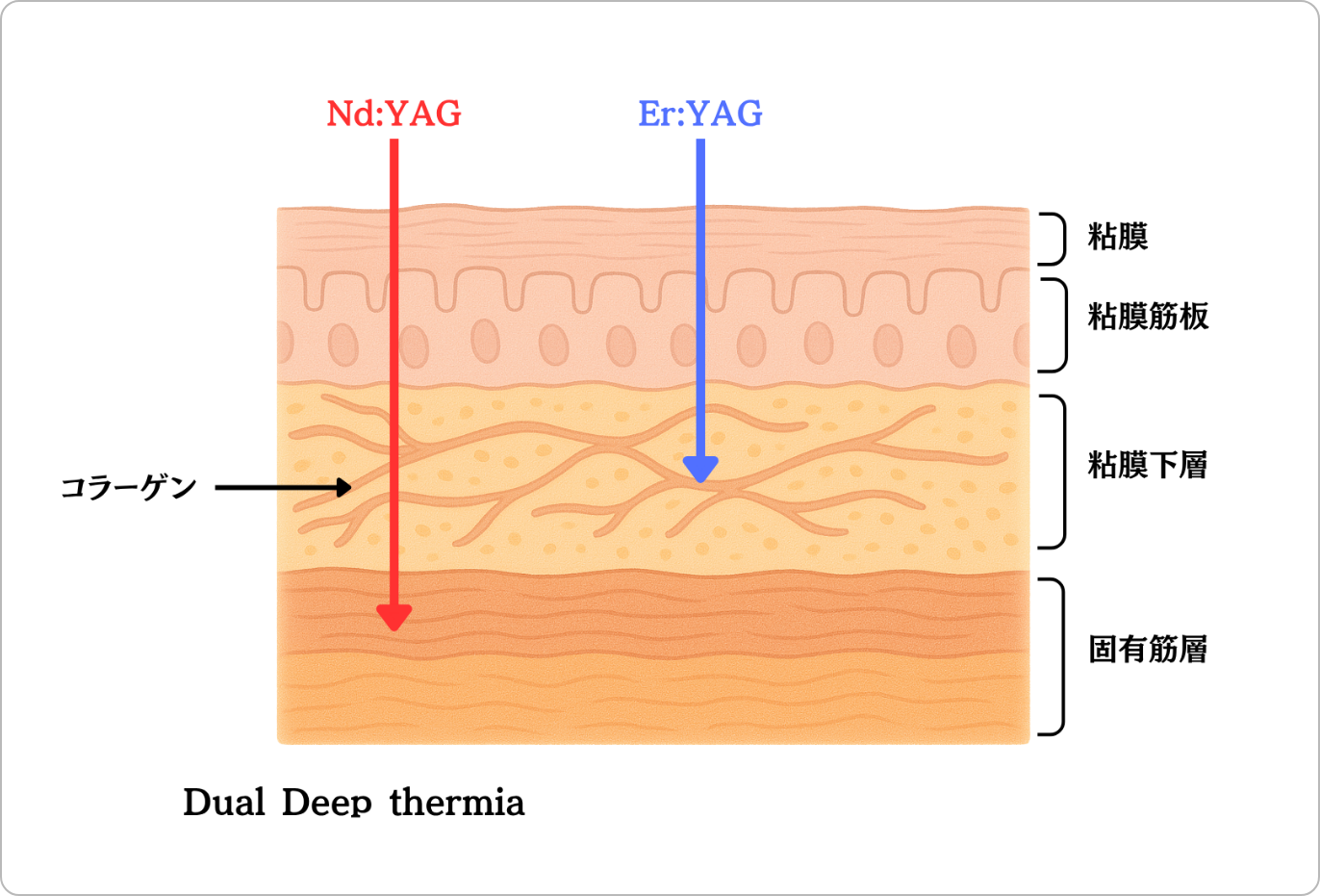 Dual Deep Thermiaのイメージ